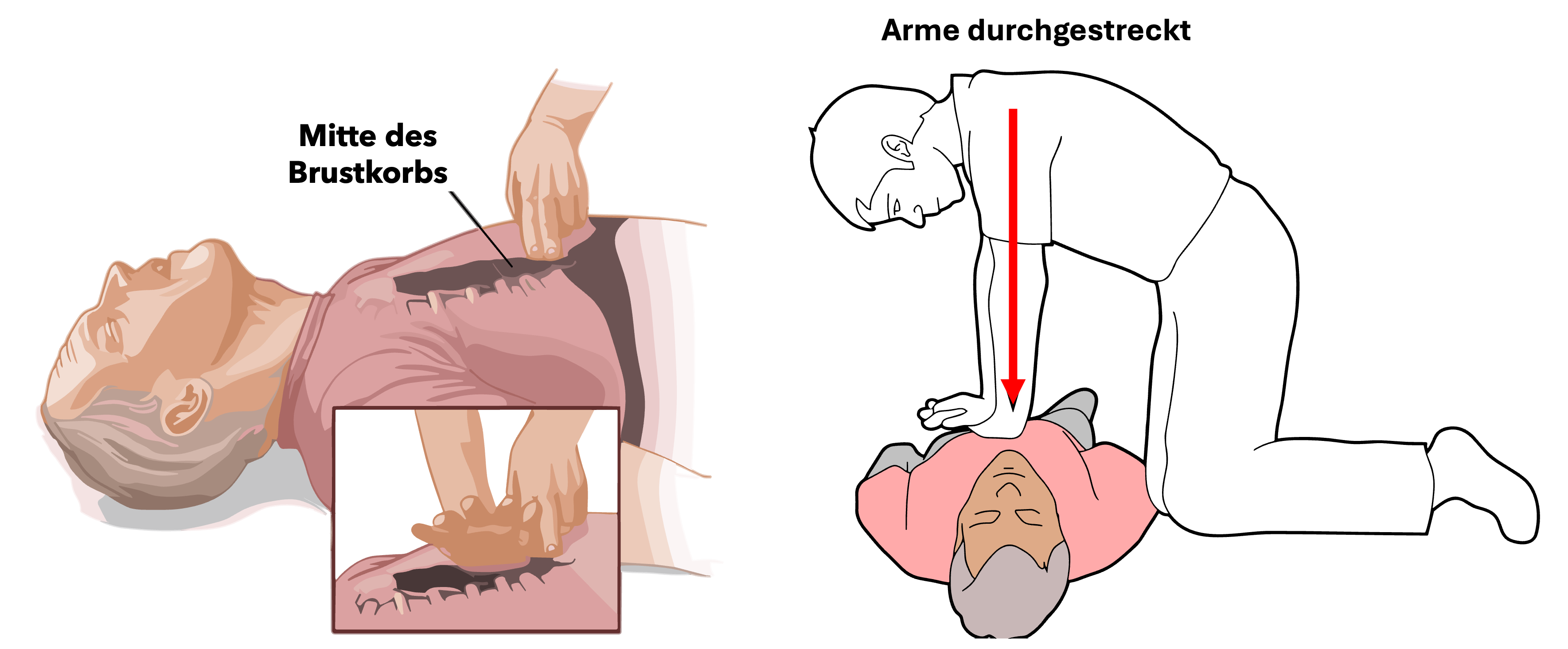 Position der Hand auf dem Brustkorb